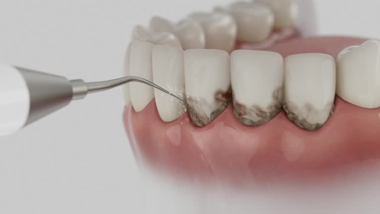 Trusted Emergency Dentist service in East Bangor, PA - Dentist Open Now